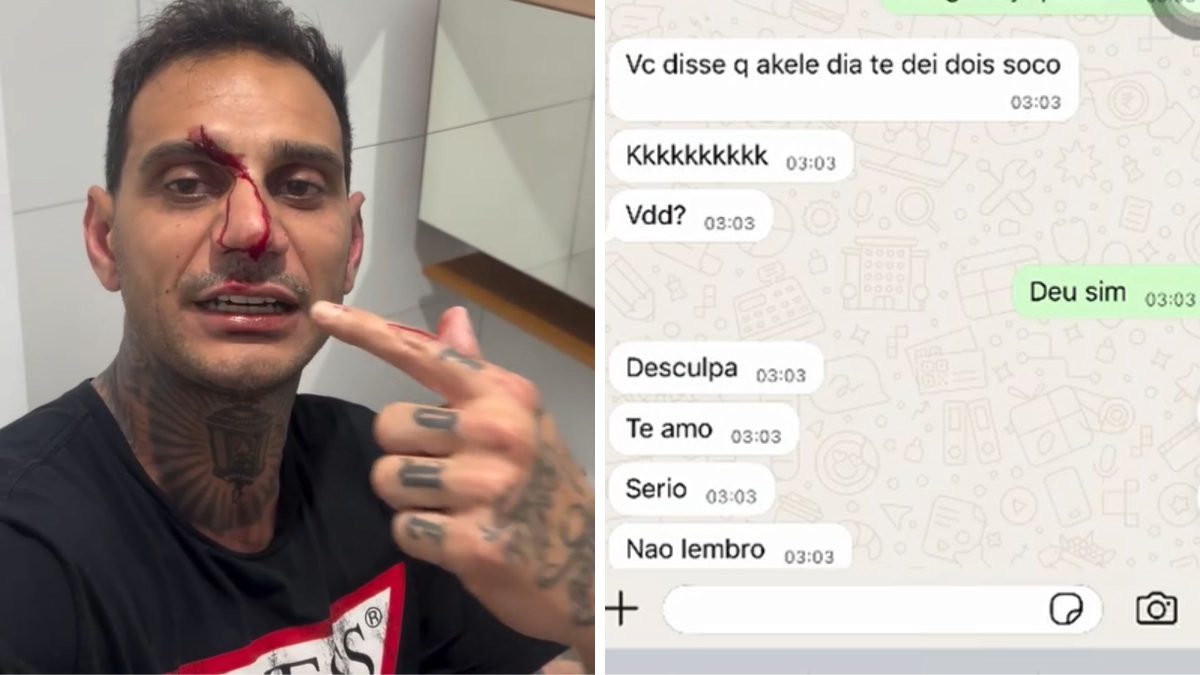 Homem acusado de agredir namorada denuncia parceira por furto e afirma ter sido agredido por ela meses antes