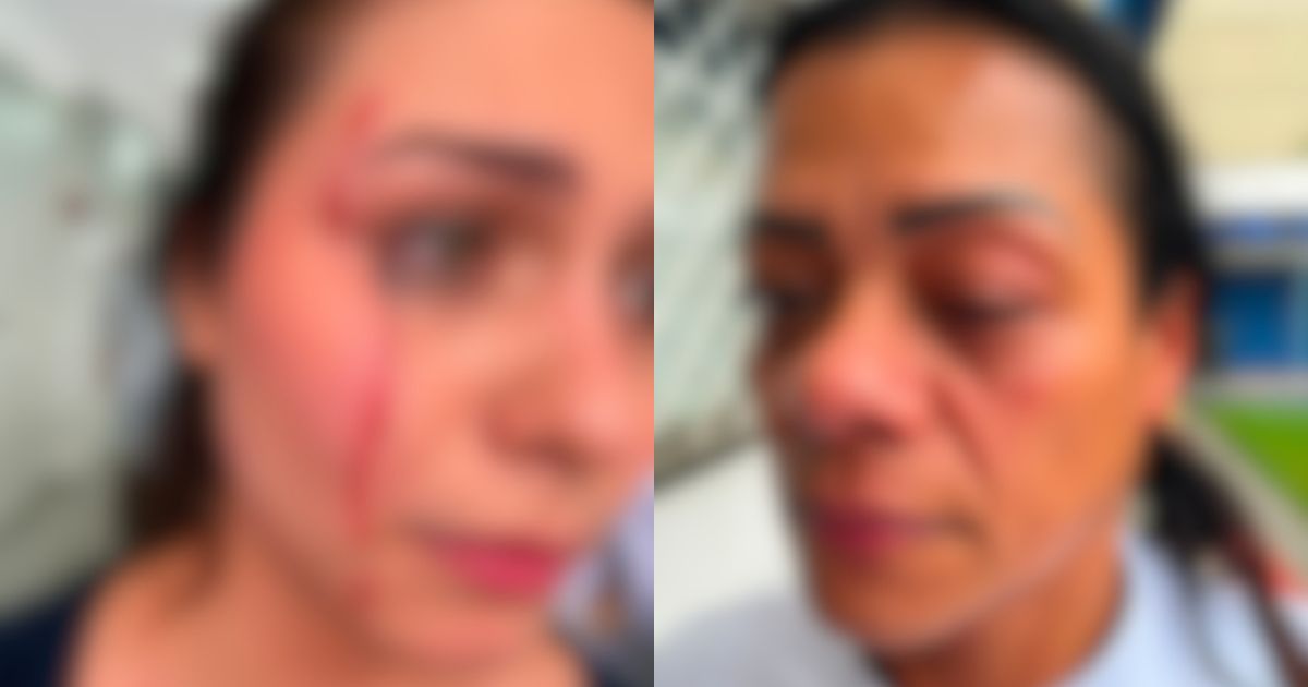 Mulher agride servidora e estagiária em centro odontológico de Balneário Camboriú com participação do filho de 9 anos