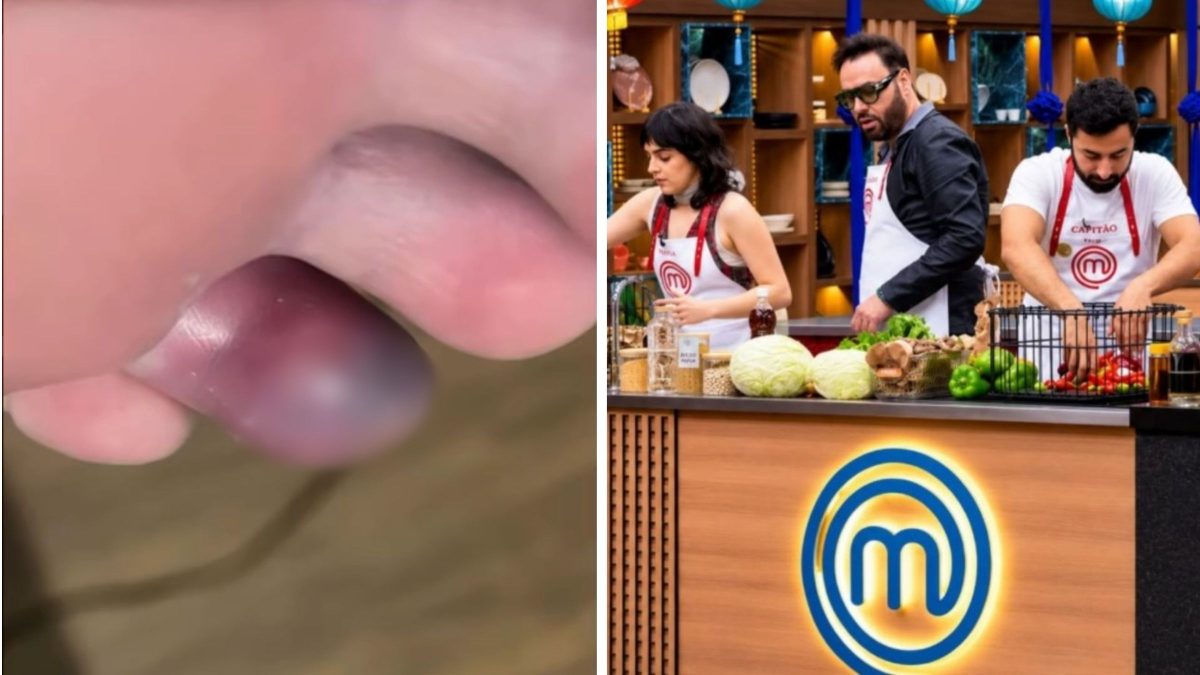 Participante de SC no MasterChef revela motivo chocante para eliminação: ‘Quase perdi um dedo’