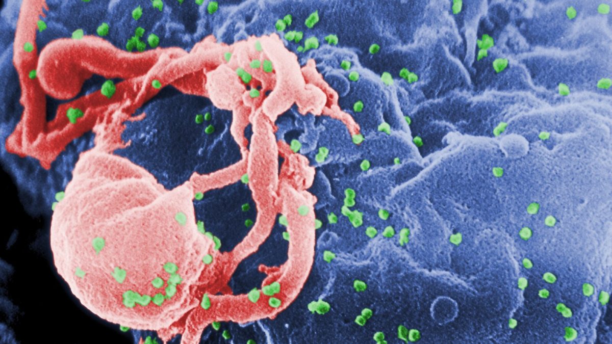 Dentista é denunciado por transmitir HIV intencionalmente a 4 mulheres; MP acredita que há mais vítimas