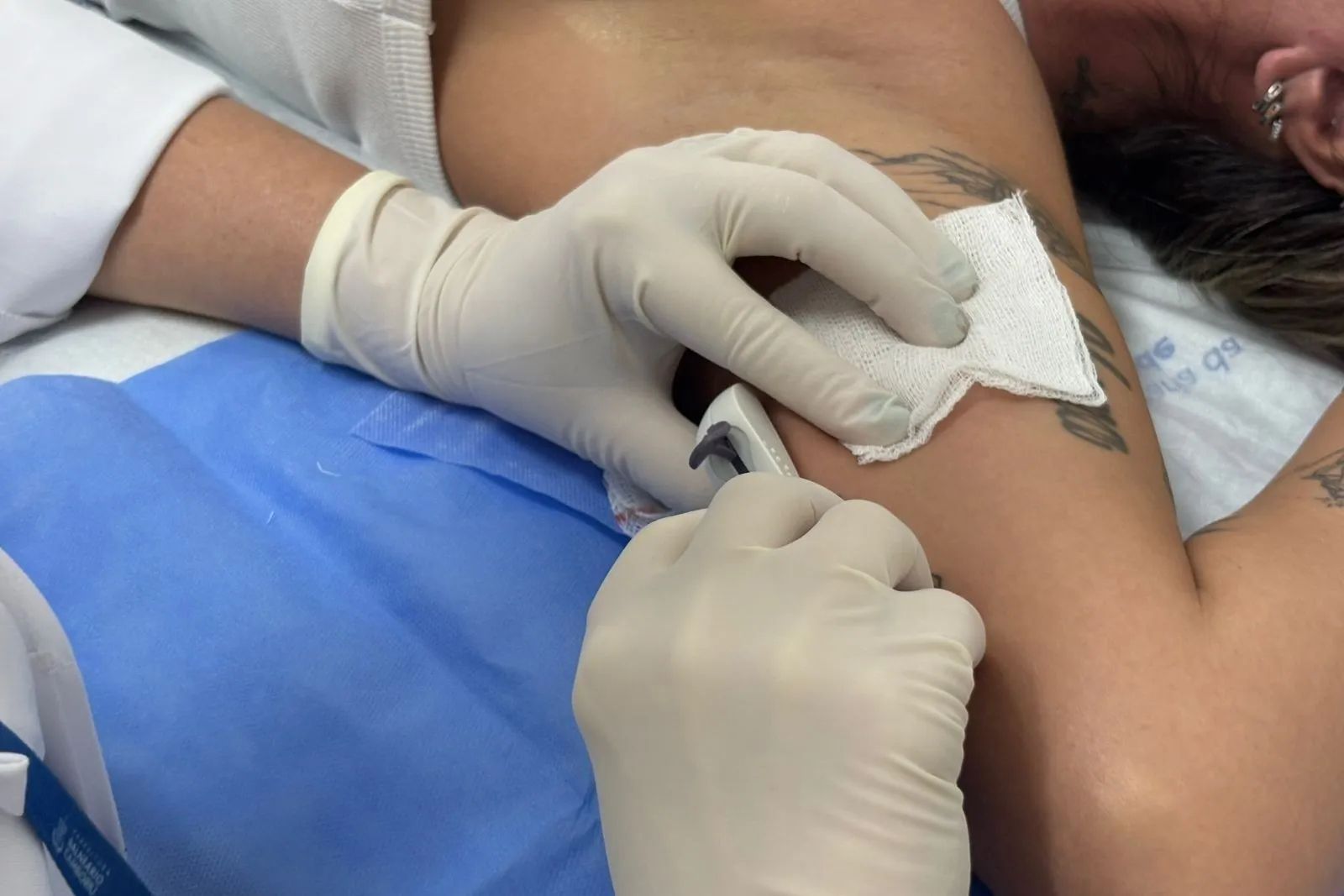 Mulheres podem solicitar DIU e Implanon gratuitamente nas UBSs de Balneário Camboriú