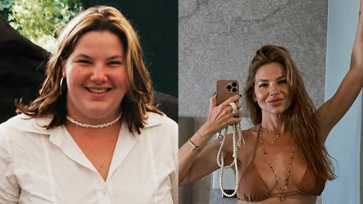 Repórter da Globo perde 75 kg após bariátrica e revela sequelas da cirurgia: “Perdi dentes”