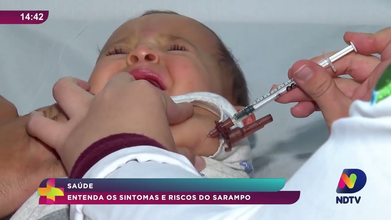 Sarampo: entenda os sintomas, riscos e como prevenir a doença