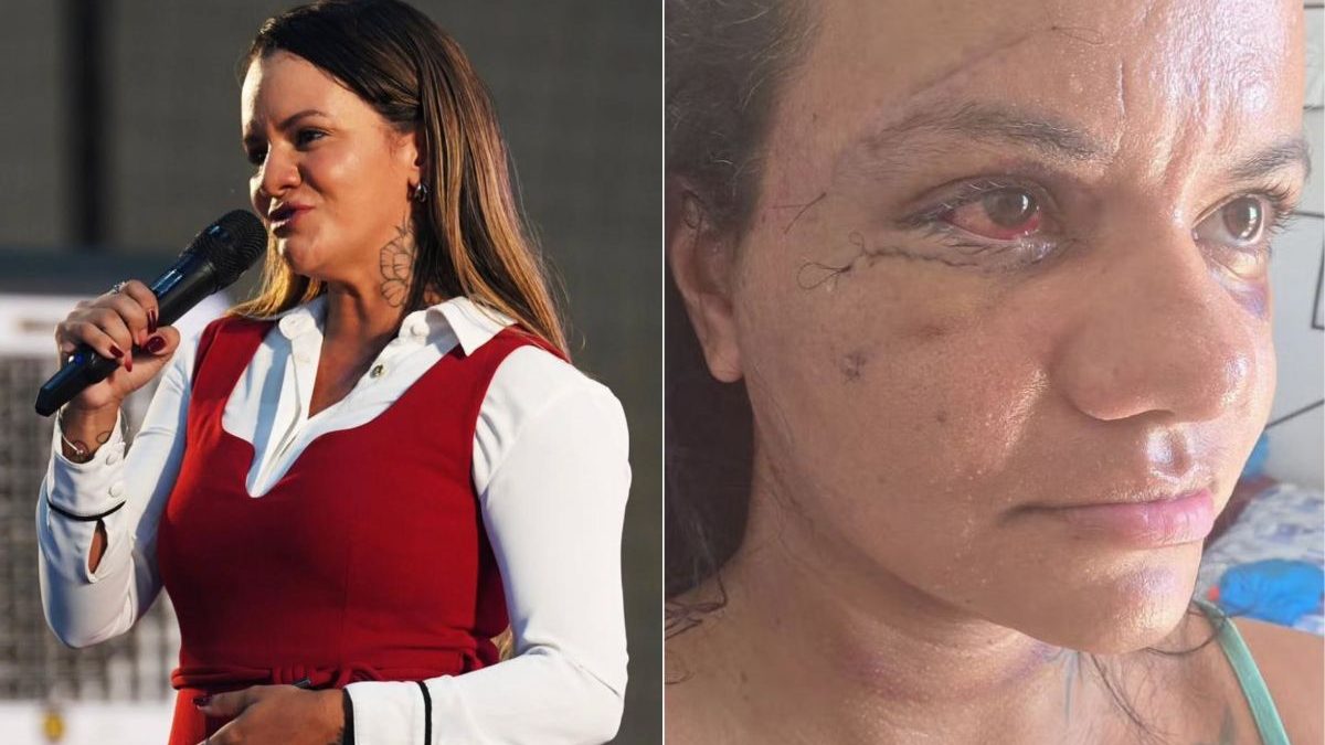 Um ano após agressão, mulher espancada com 61 socos é candidata a deputada estadual no RN: 'Vi a necessidade'
