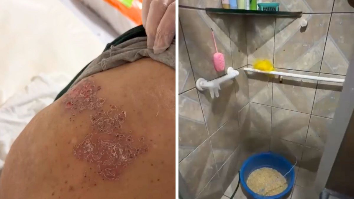 Feridas e falta de higiene: imagens revelam condições precárias de casa clandestina que abrigava idosos em Joinville