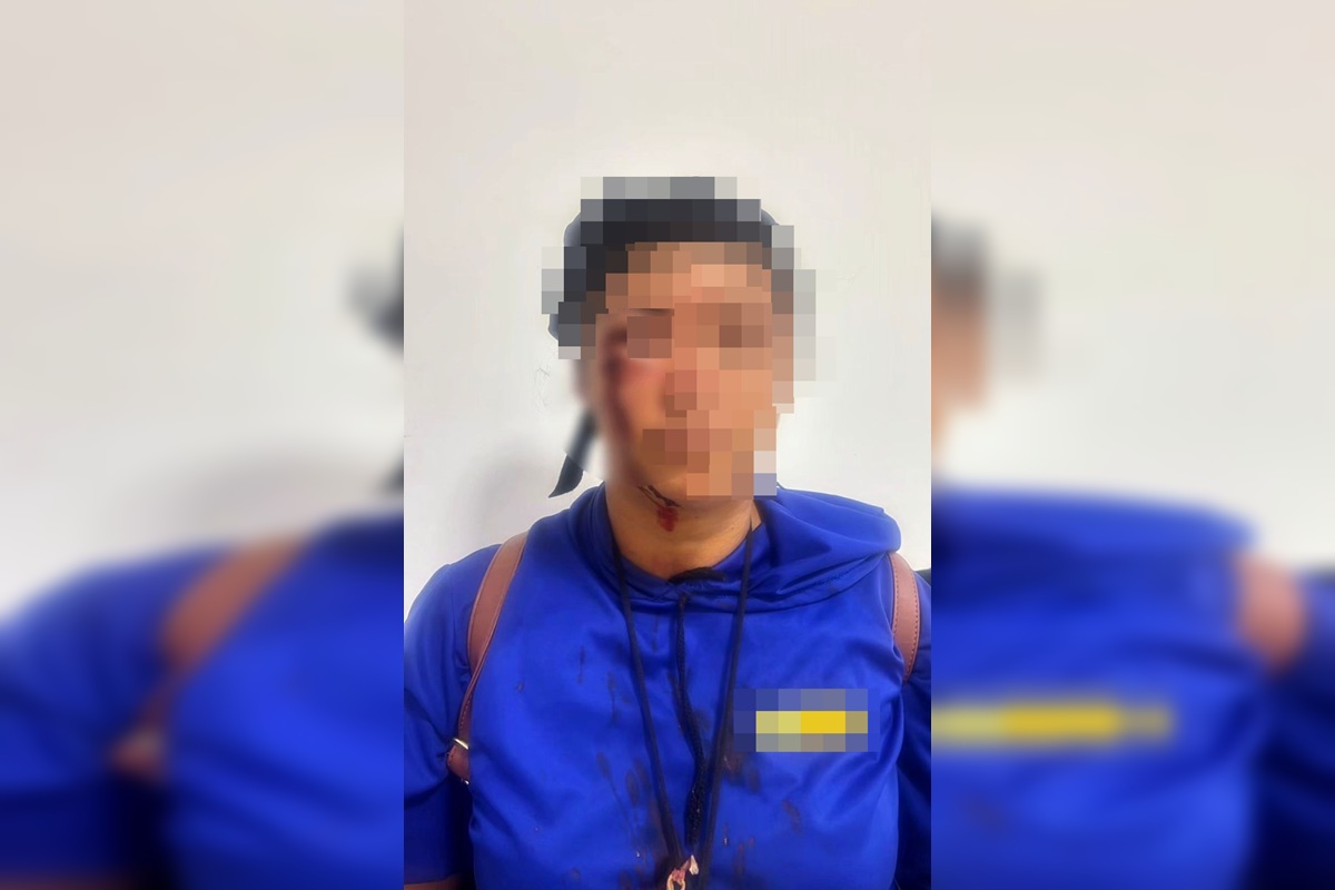 "Colocar pimenta no seu prikito", ameaçou agressora que chicoteou mulher
